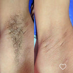 Creme Depilatório 250g