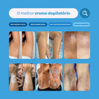 Creme Depilatório 250g