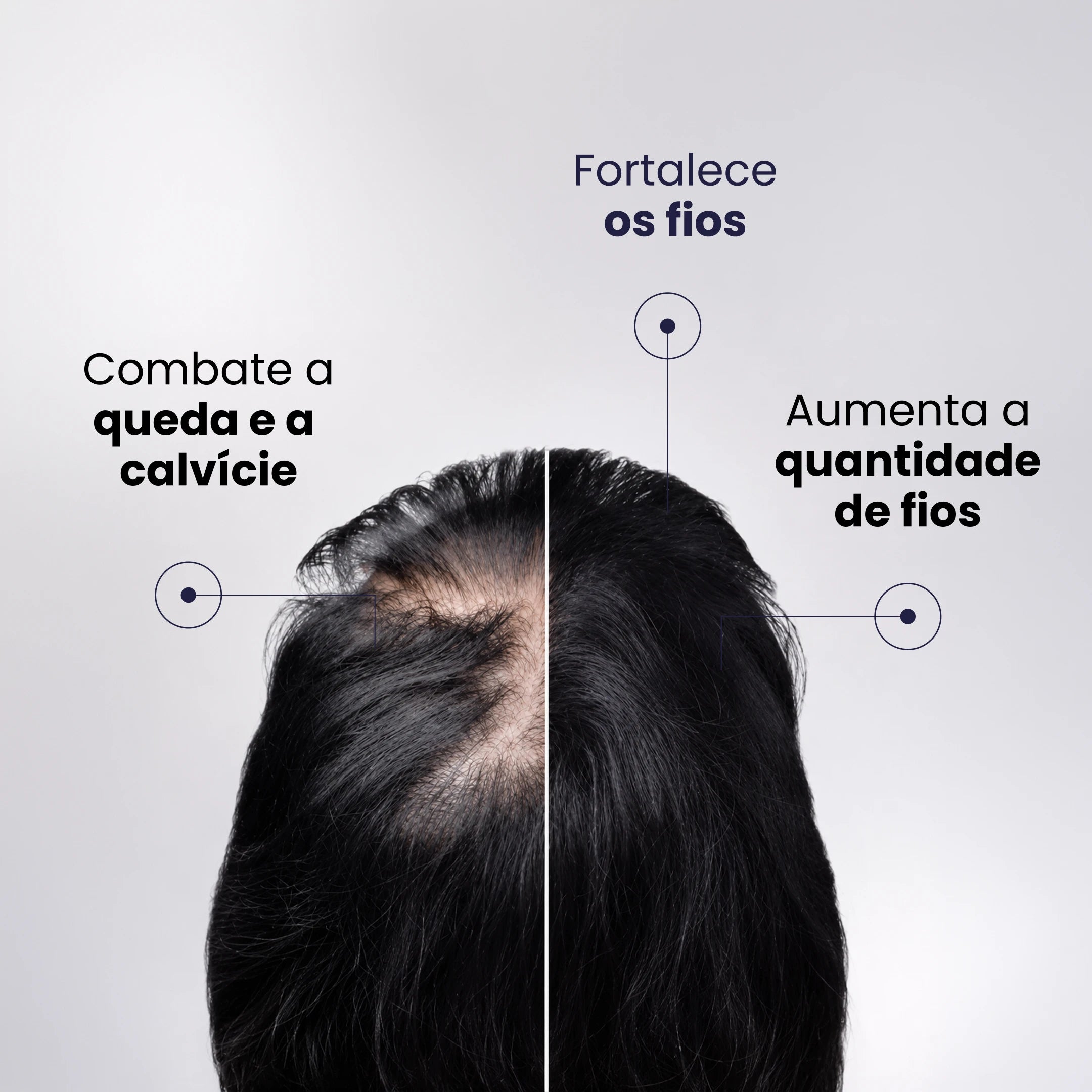 Tônico Ultravin Crescimento Acelerado