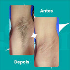 Creme Depilatório Depila Sem Dor YouShine 250g