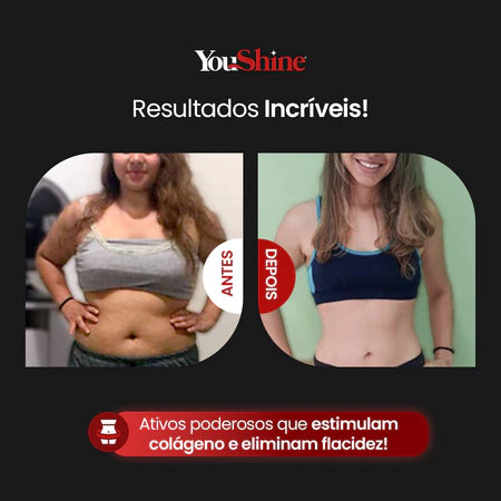 Gel Redutor de Medidas Pimenta Negra YouShine 500g Elimina Gordura Localizada Flacidez e Celulites