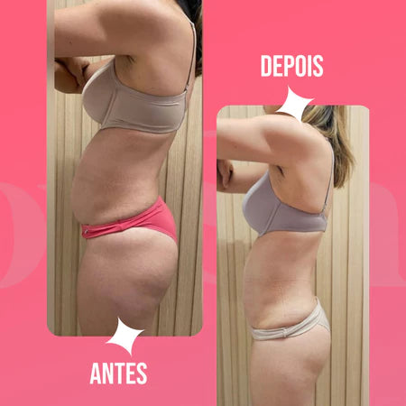 Creme Drenagem Linfática Ácido Hialurônico Massagem YouShine 500g Reduz Flacidez e Celulites